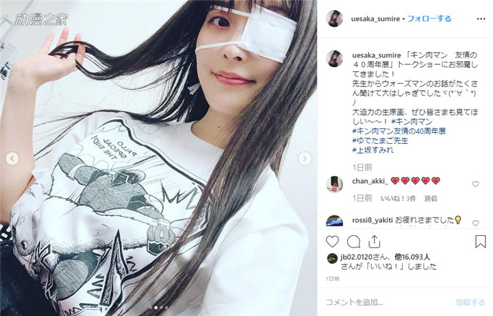 声优上坂堇出席活动佩戴眼罩引网友担心